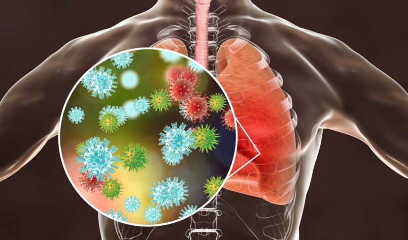 Traitement infection pulmonaire à mycoplasme