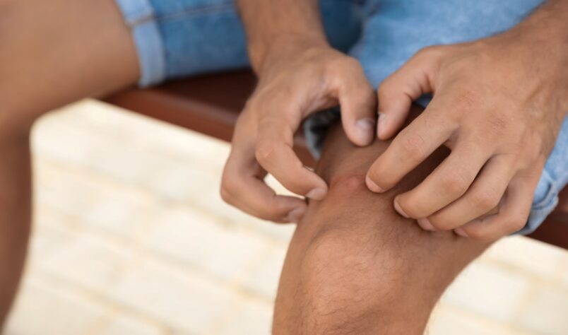 traitement arthrite de lyme au stade I